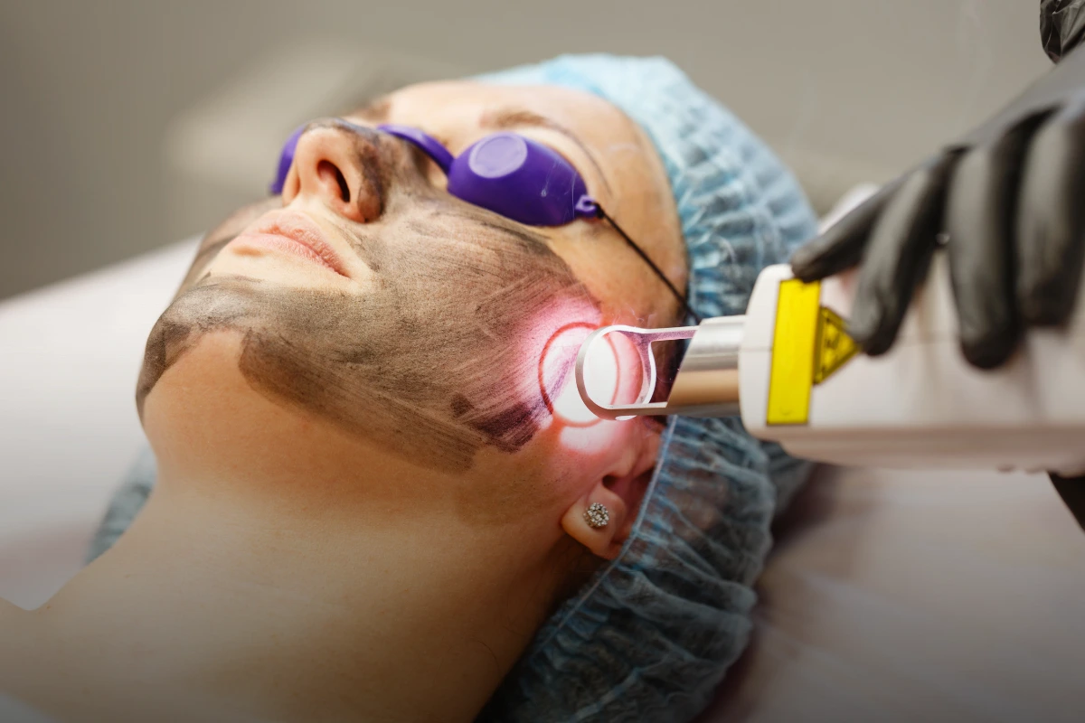 Laser treatments at Taara Skin and Hair Clinic